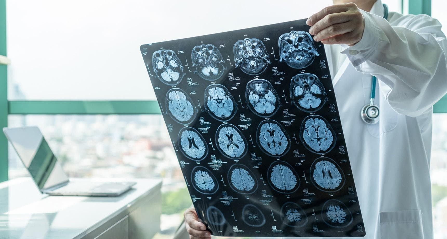 The role of digital therapeutics in central nervous system clinical trials