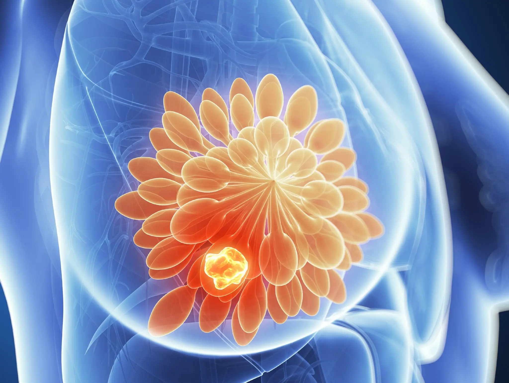 AstraZeneca’s Truqap plus Faslodex approved by FDA for treatment of breast cancer