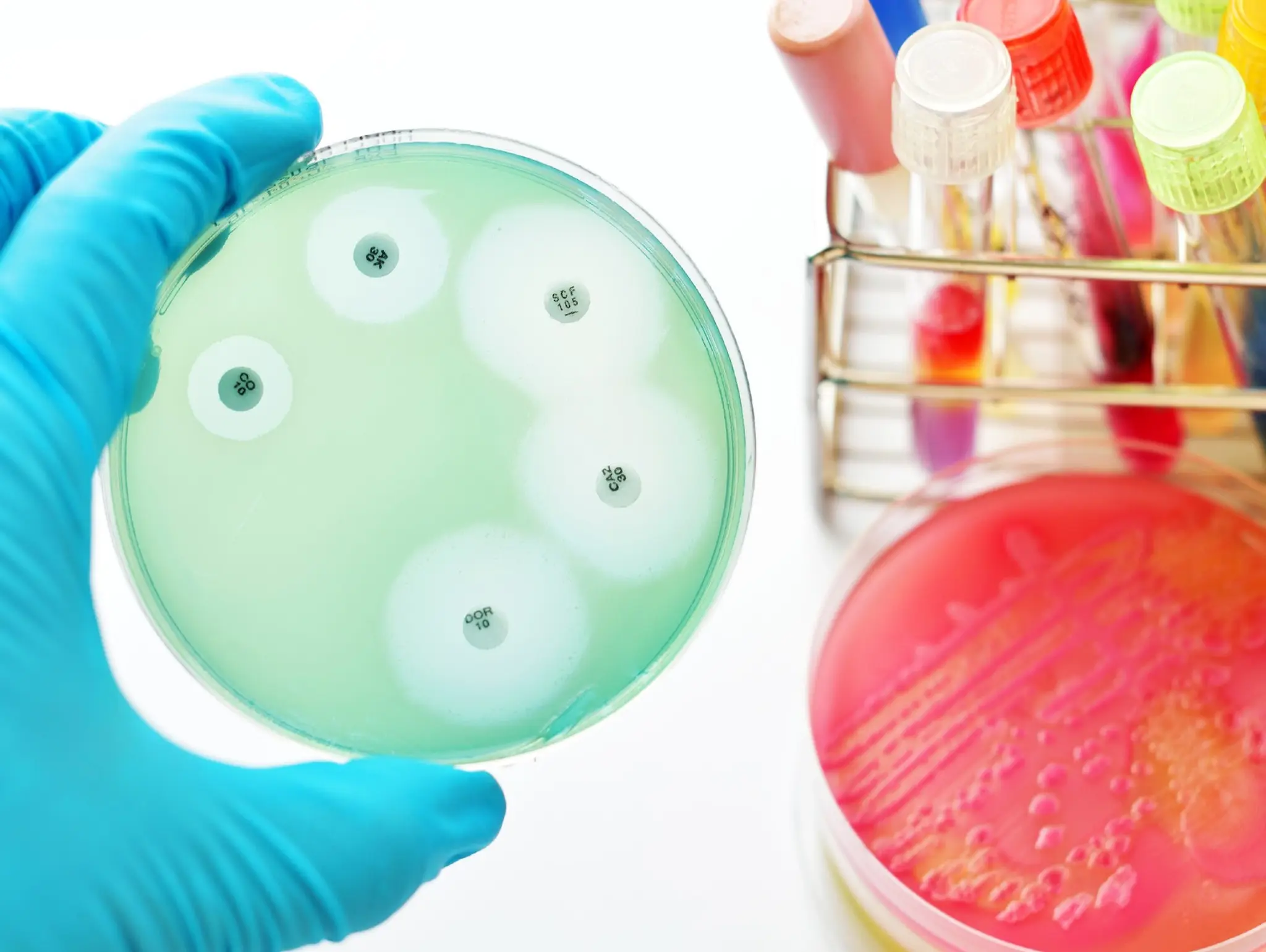 Five facts about antimicrobial resistance