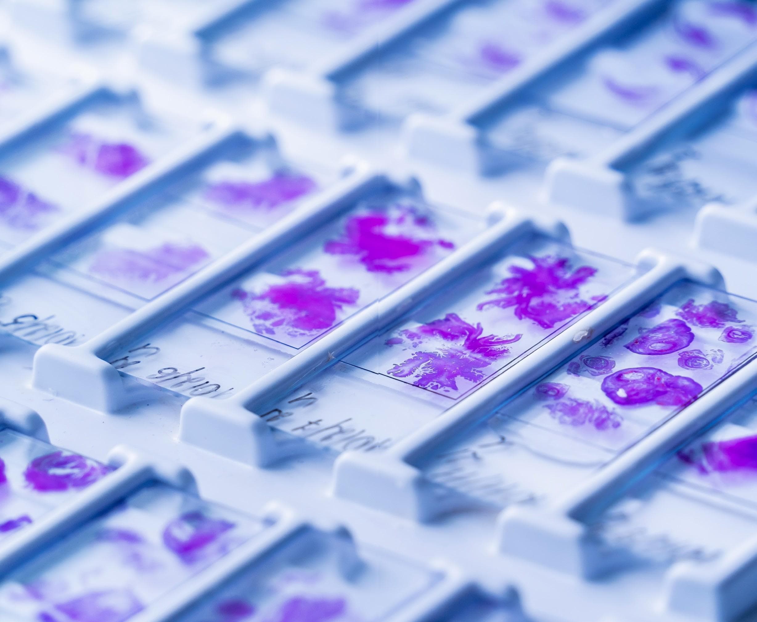 Real time cell analysis