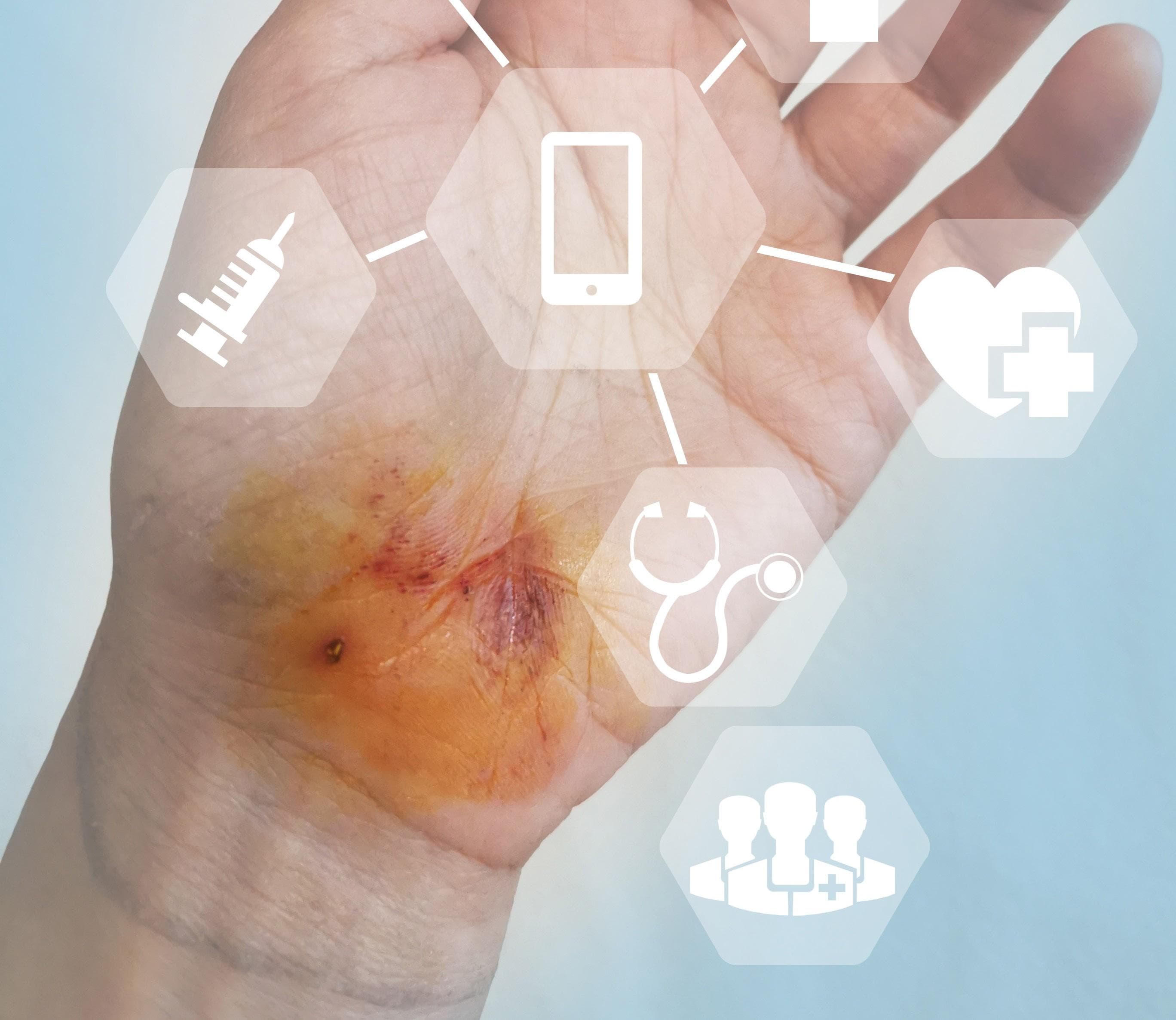 How can AI contribute to improving wound care in the UK