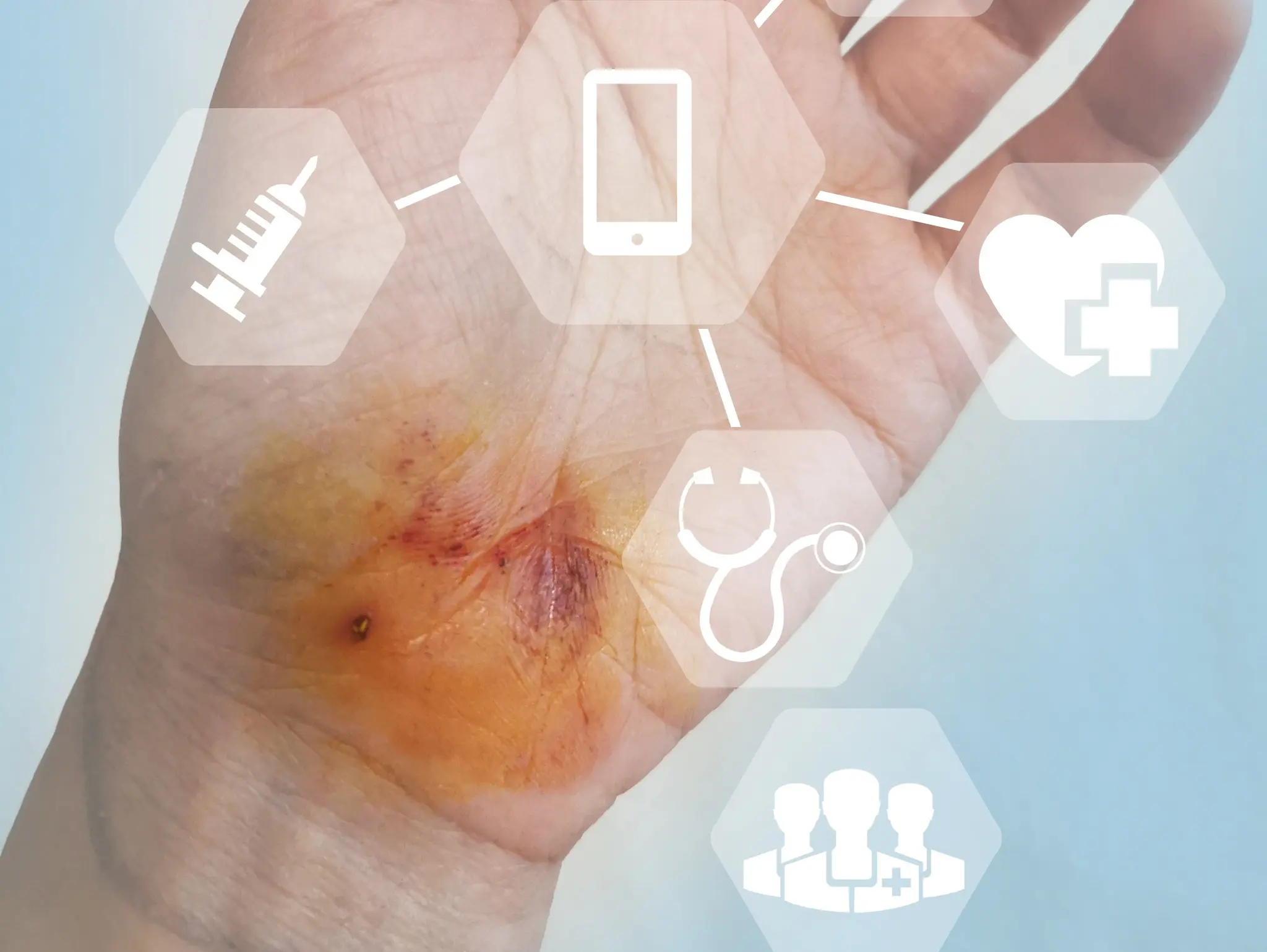 How can AI contribute to improving wound care in the UK