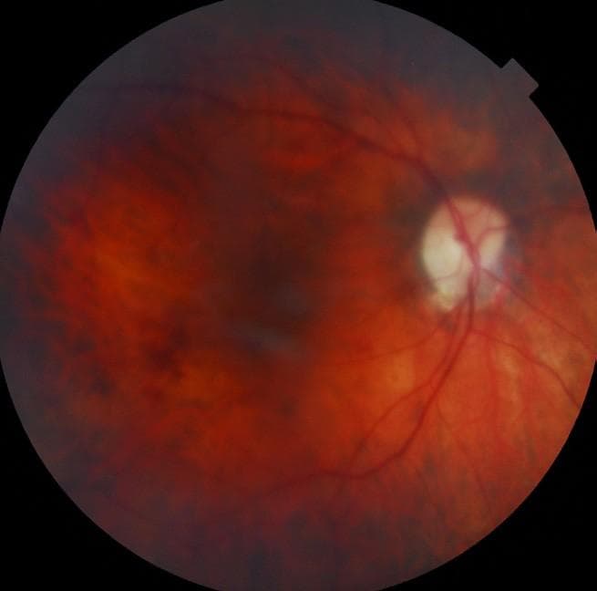 Pondering the Imponderable