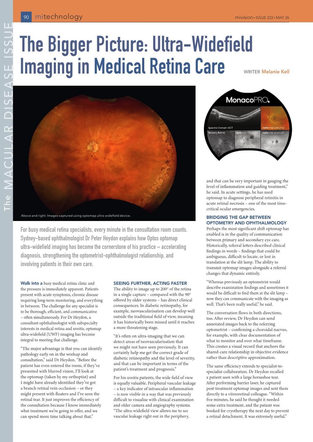 mivision.pdf - Page 64