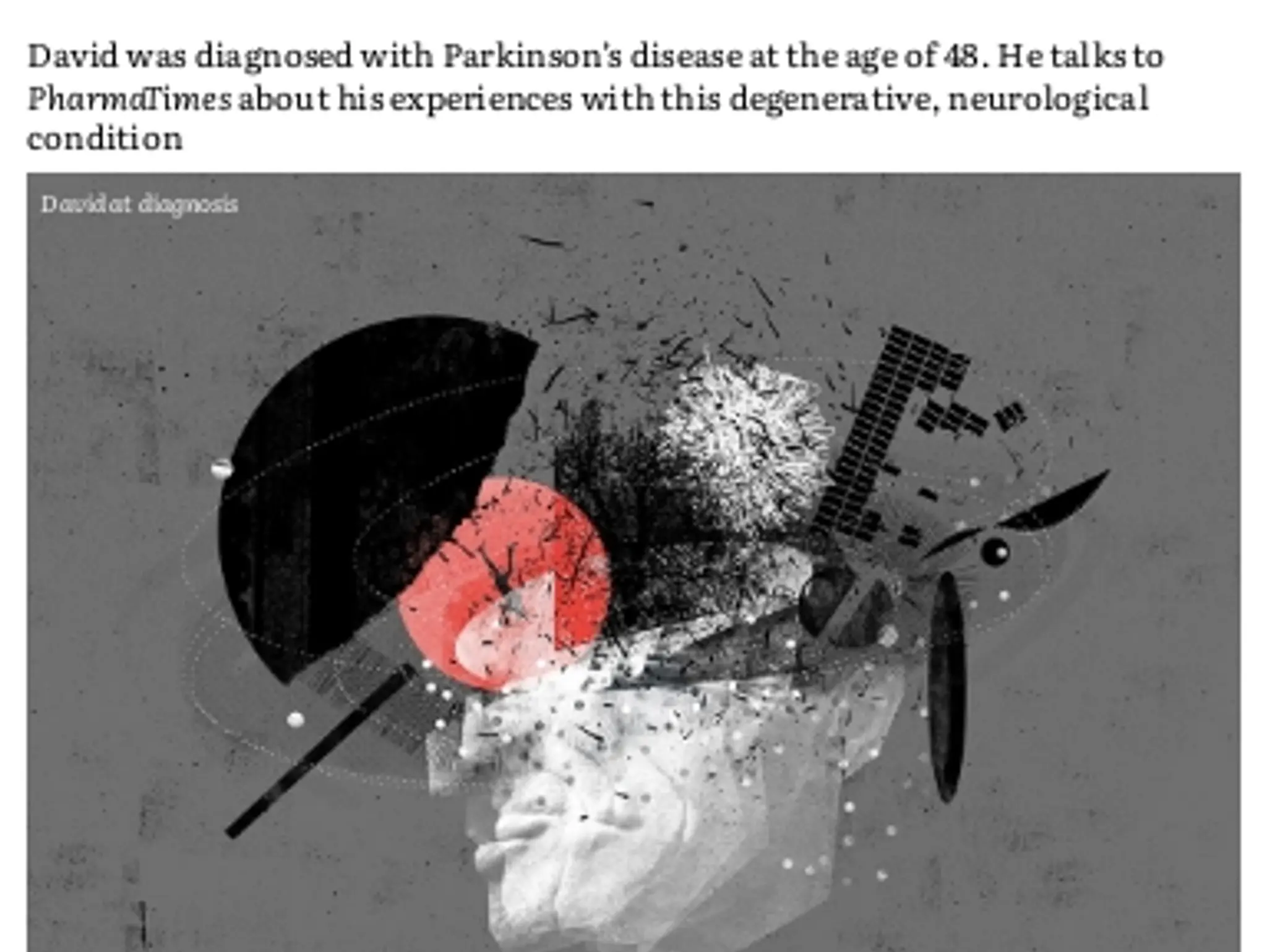 38-39 - Patient file: Parkinson’s Disease