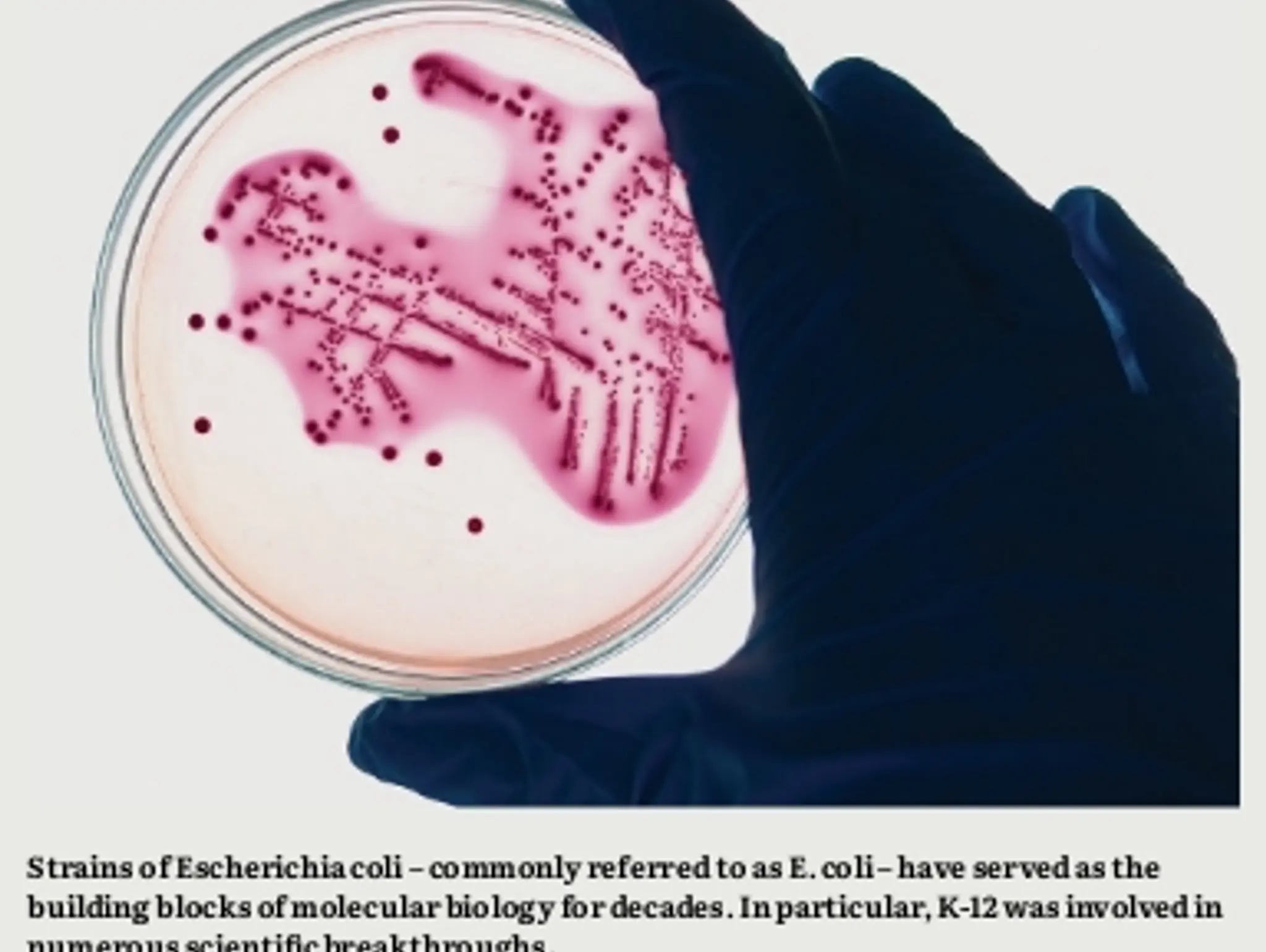 24-25 - HISTORY: It’s 100 Years of E. coli!