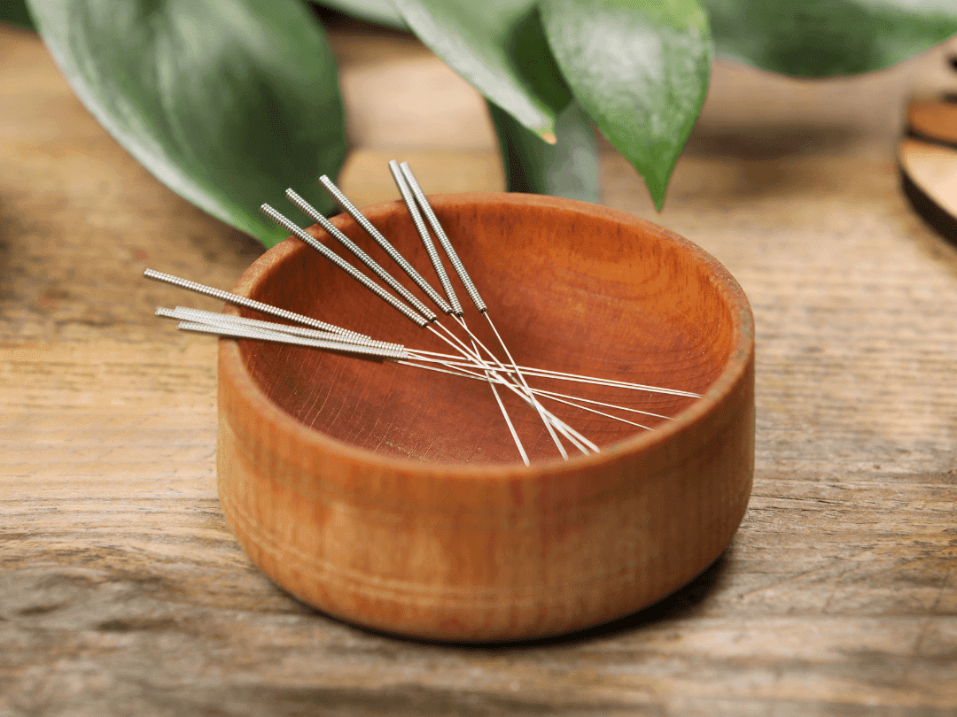 Acupuncture for Stress, Pain, and Overall Wellness