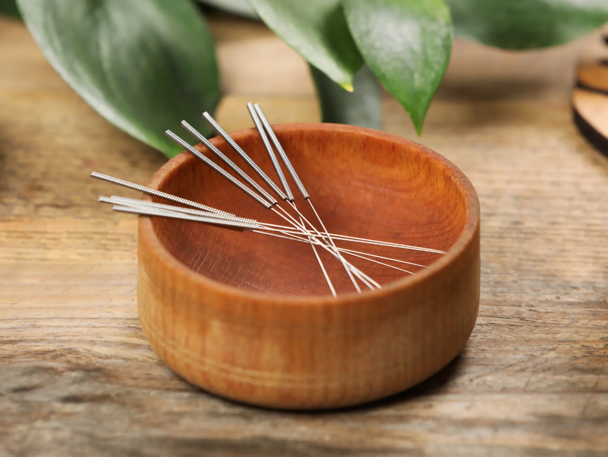 Acupuncture for Stress, Pain, and Overall Wellness