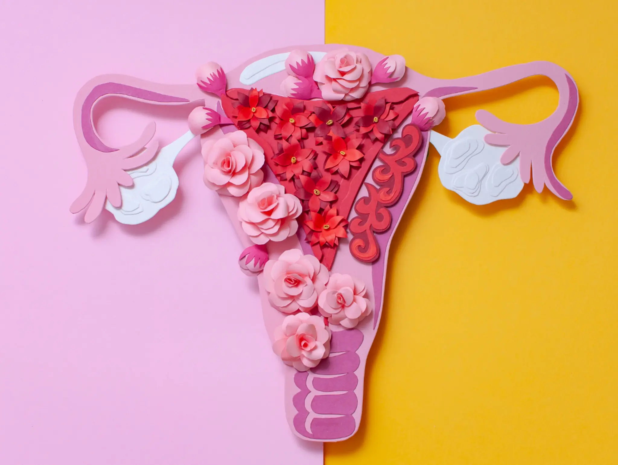 Understanding Endometriosis: What It Is and How It Affects Women