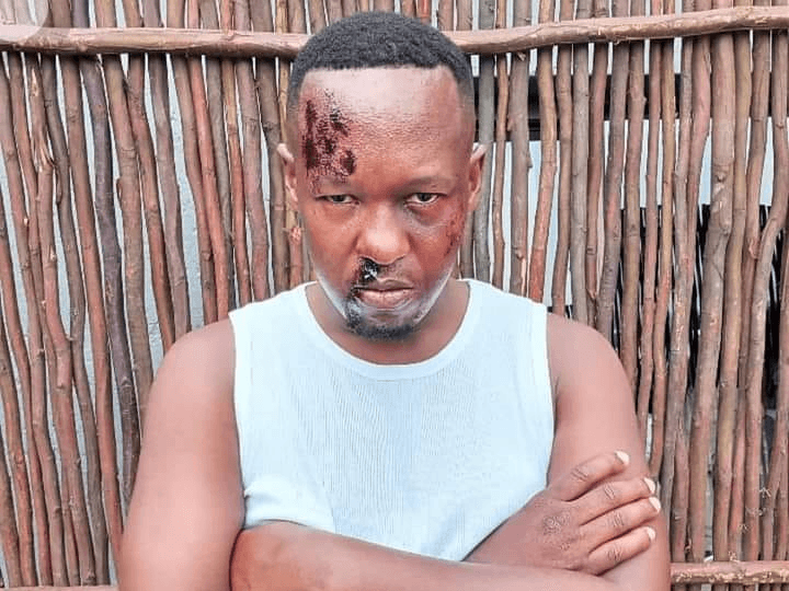 07. Izingqinamba ziphoqe umlingisi ukuba afundele ukwakha ifenisha