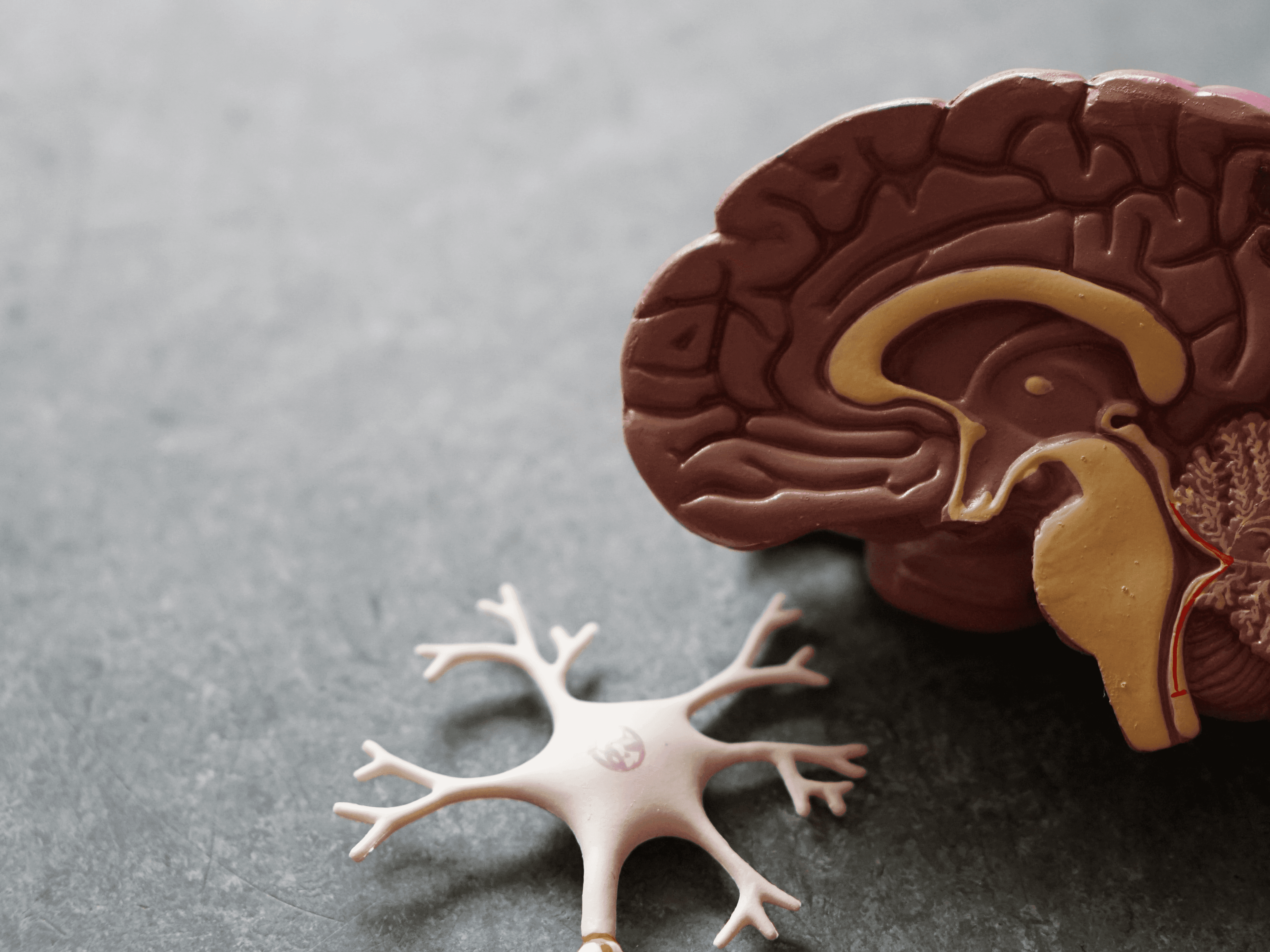 Eli Lilly shares positive results from phase 3 study of donanemab for early Alzheimer’s disease