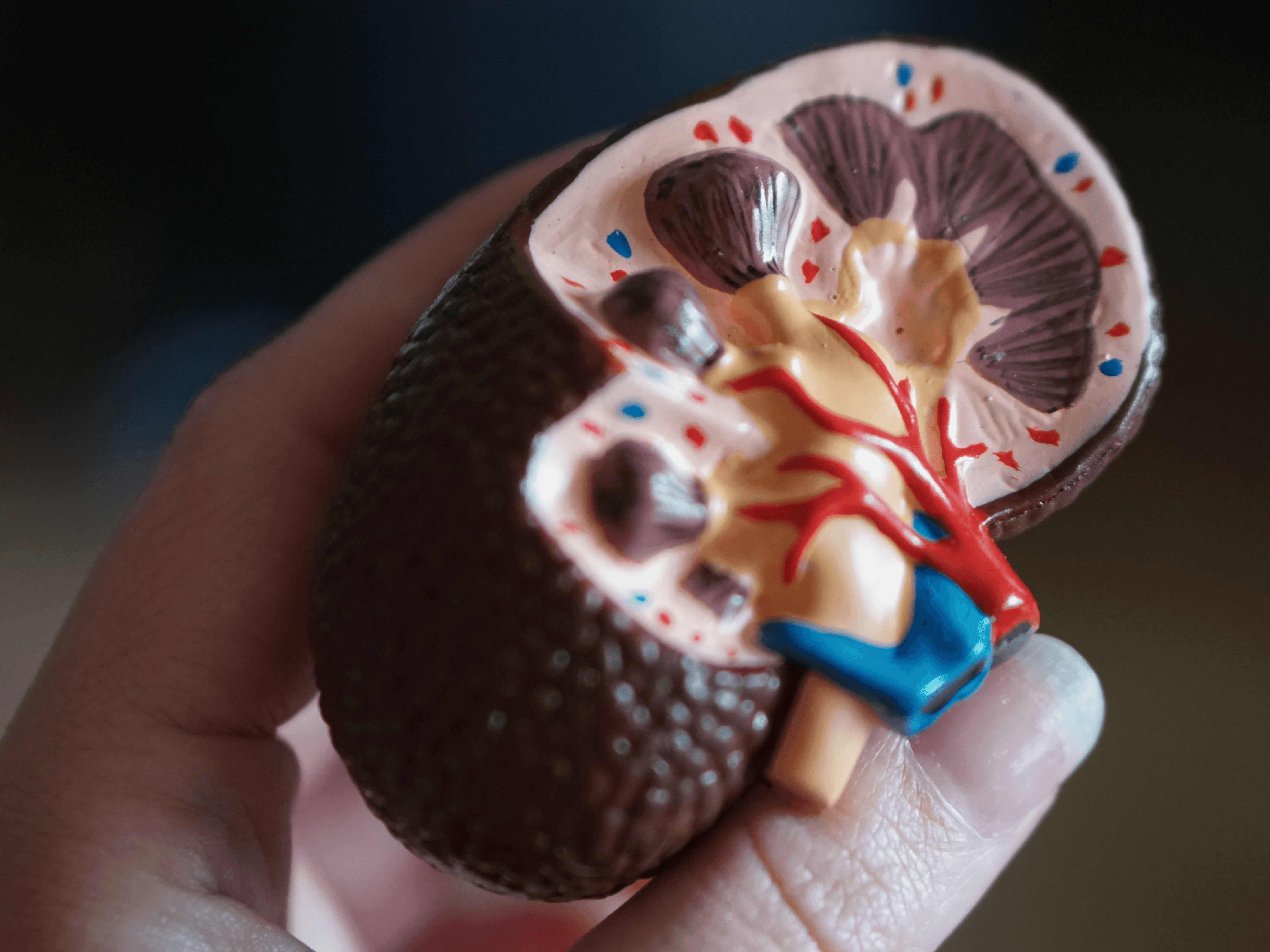 Johnson & Johnson’s Ethicon Undertakes First Robot-assisted Kidney Stone Removal